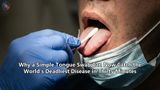 Why a Simple Tongue Swab Can Now Catch the World's Deadliest Disease in Thirty Minutes