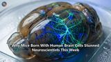 Why Mice Born With Human Brain Cells Stunned Neuroscientists This Week
