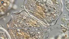 How Stanford's New Dye-Free Microscope Films Living Cells Undamaged