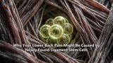 Why Your Lower Back Pain Might Be Caused by Newly Found Ligament Stem Cells