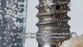 Why Dentists Warn Today's Sparkling Water Is Rapidly Dissolving Dental Implants