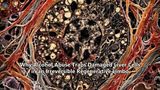 Why Alcohol Abuse Traps Damaged Liver Cells in an Irreversible Regenerative Limbo