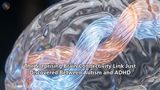 The Surprising Brain Connectivity Link Just Discovered Between Autism and ADHD