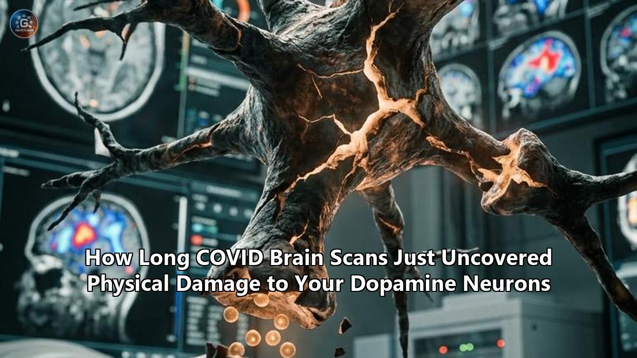 How Long COVID Brain Scans Just Uncovered Physical Damage to Your Dopamine Neurons