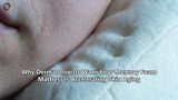 Why Dermatologists Warn Your Memory Foam Mattress Is Accelerating Skin Aging