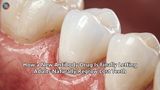 How a New Antibody Drug Is Finally Letting Adults Naturally Regrow Lost Teeth
