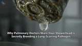 Why Pulmonary Doctors Warn Your Showerhead Is Secretly Breeding a Lung-Scarring Pathogen