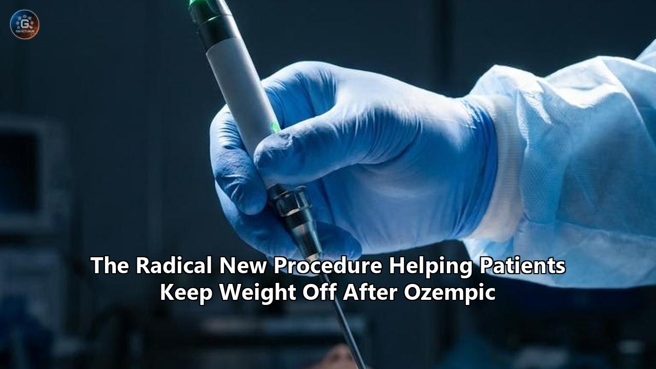The Radical New Procedure Helping Patients Keep Weight Off After Ozempic