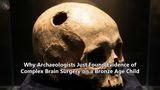 Why Archaeologists Just Found Evidence of Complex Brain Surgery on a Bronze Age Child