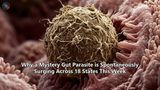 Why a Mystery Gut Parasite is Spontaneously Surging Across 18 States This Week