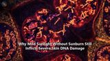 Why Mild Sunlight Without Sunburn Still Inflicts Severe Skin DNA Damage