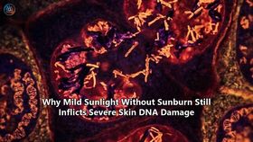 Why Mild Sunlight Without Sunburn Still Inflicts Severe Skin DNA Damage