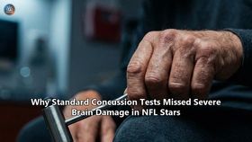 Why Standard Concussion Tests Missed Severe Brain Damage in NFL Stars