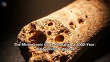 The Microscopic Clues Revealing a 4000-Year-Old Syphilis Outbreak