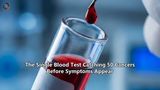 The Single Blood Test Catching 50 Cancers Before Symptoms Appear