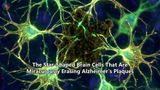 The Star-Shaped Brain Cells That Are Miraculously Erasing Alzheimer's Plaques